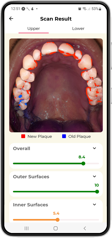 Testmyteeth Dental App highlights plaque you have missed when brushing your teeth